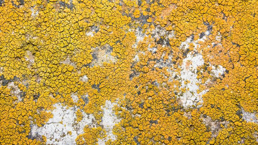 Dermite séborrhéique : pellicules, rougeurs et squames grasses du visage